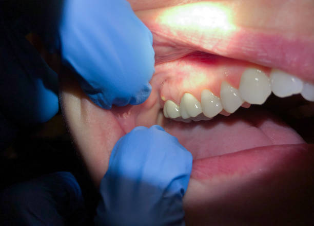 Best After-Hours Emergency Dentist in Old Saybrook Center, CT